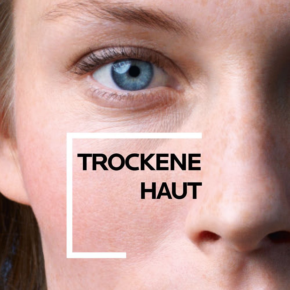 Nahaufnahme eines Gesichts mit dem Text "Trockene Haut" in einem weißen Rahmen.