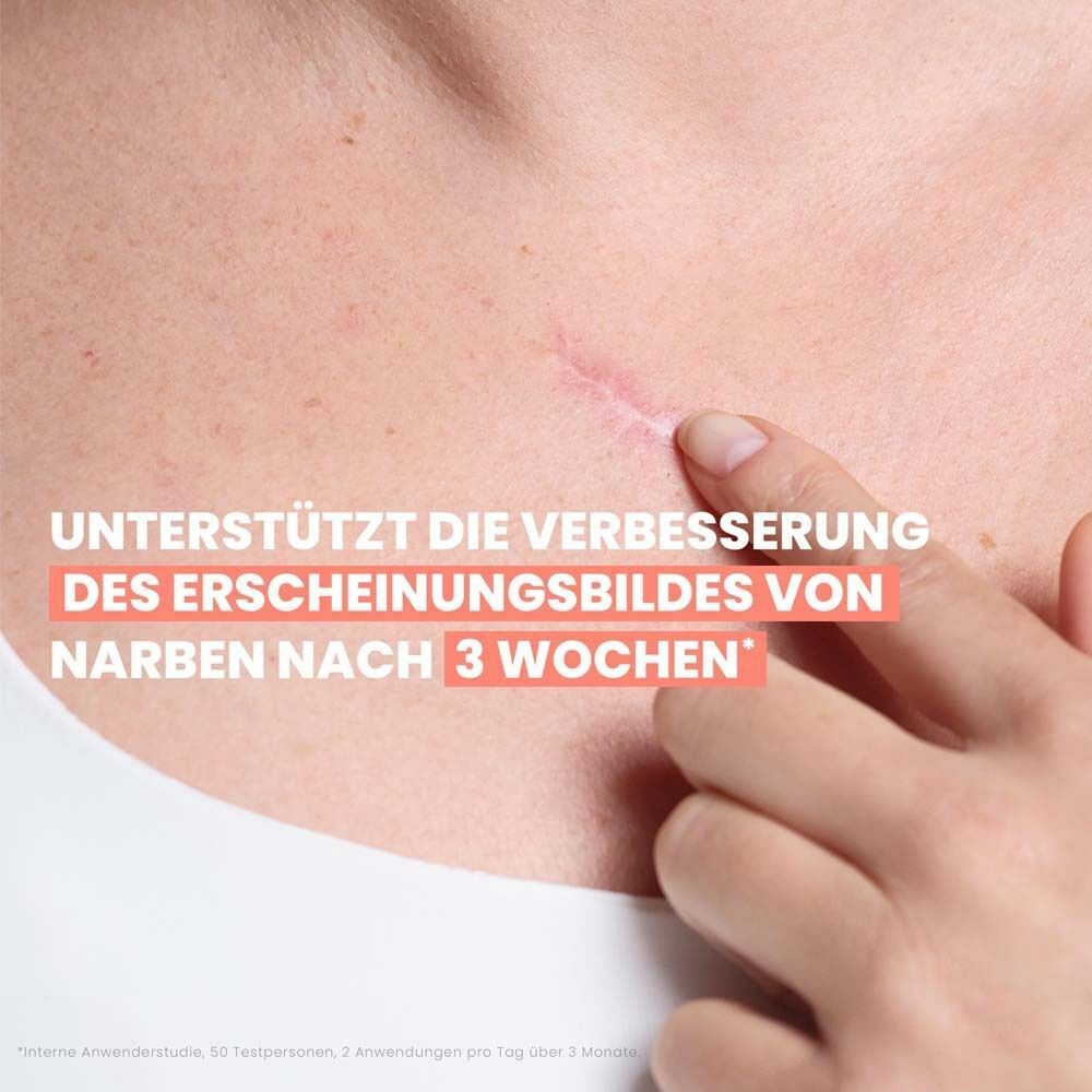 Nahaufnahme einer Narbe auf der Haut. Text: Unterstützt die Verbesserung des Erscheinungsbildes von Narben nach 3 Wochen.