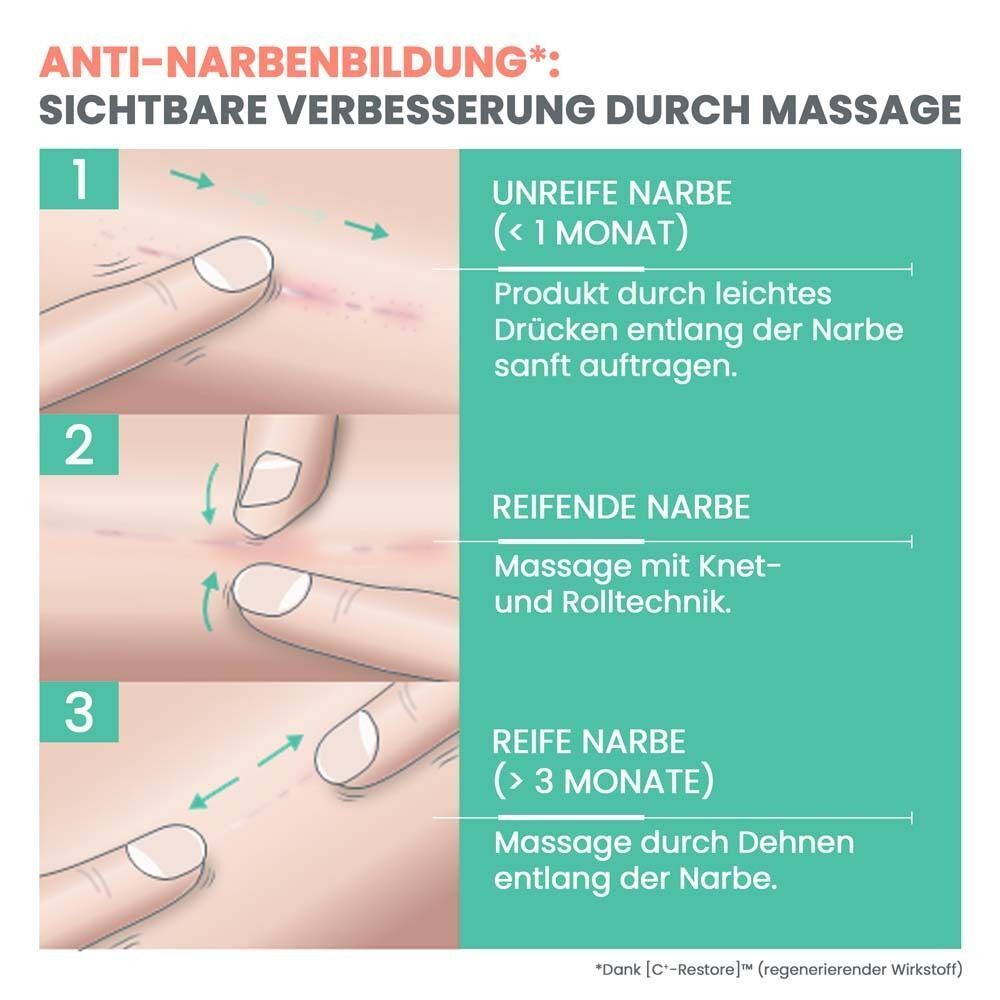 Anleitung zur Narbenmassage. 3 Schritte: unreife, reifende und reife Narben. Text: Sichtbare Verbesserung.