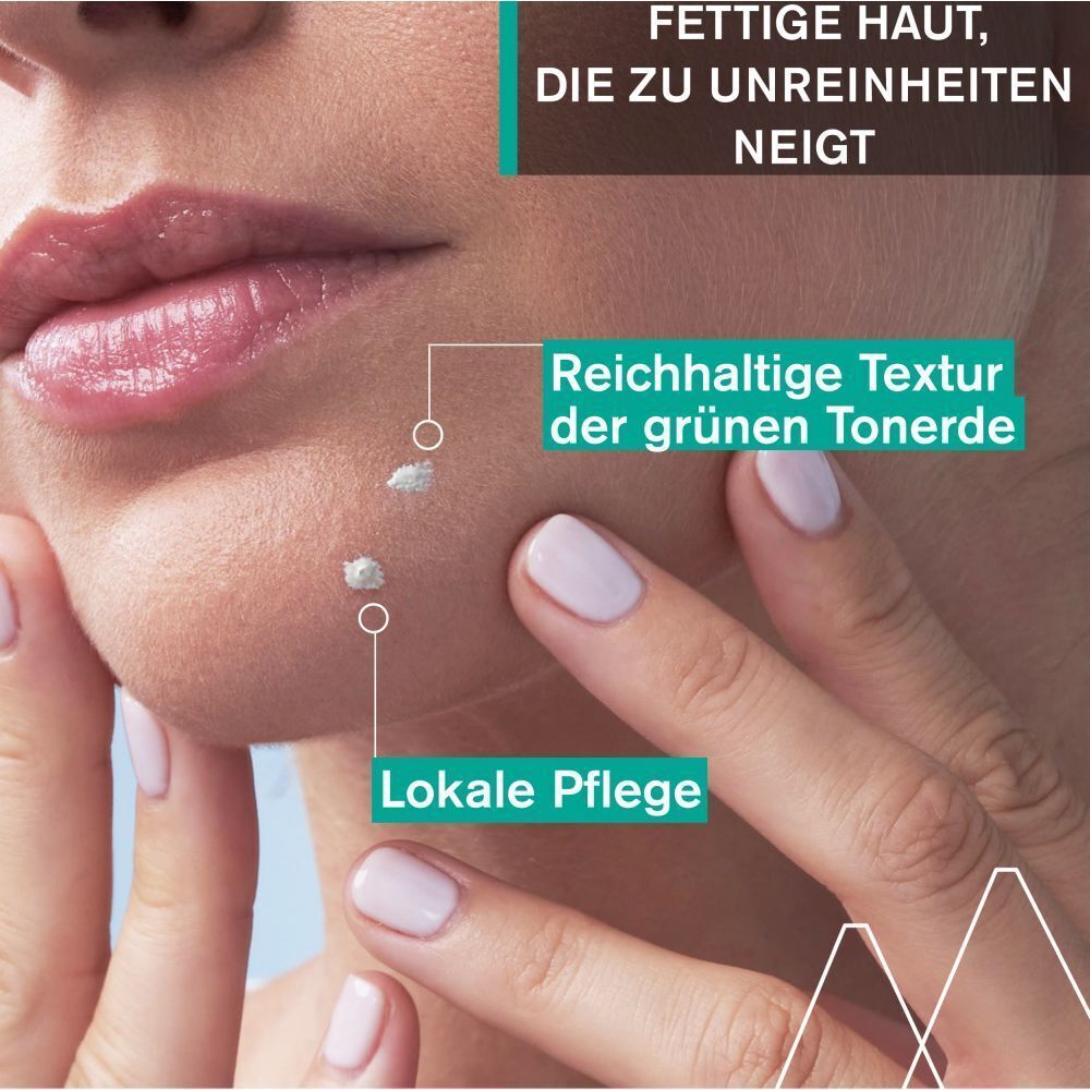 Nahaufnahme einer Frau. Auf der Haut sind weiße Punkte zu sehen. Text: Fettige Haut, die zu Unreinheiten neigt. Lokale Pflege. Reichhaltige Textur der grünen Tonerde.