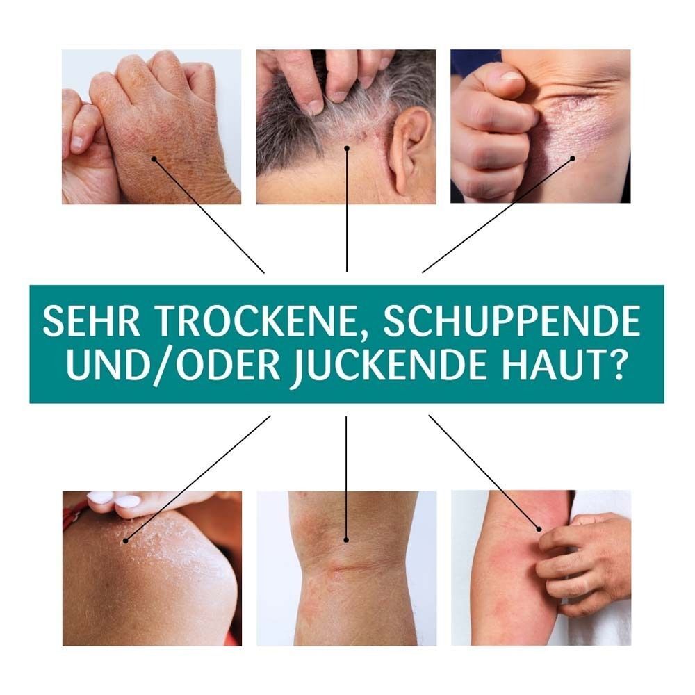 Grafik mit Bildern von Hautpartien: Hände, Kopfhaut, Ellenbogen, Knie, Arm. Text: Sehr trockene, schuppende und/oder juckende Haut?