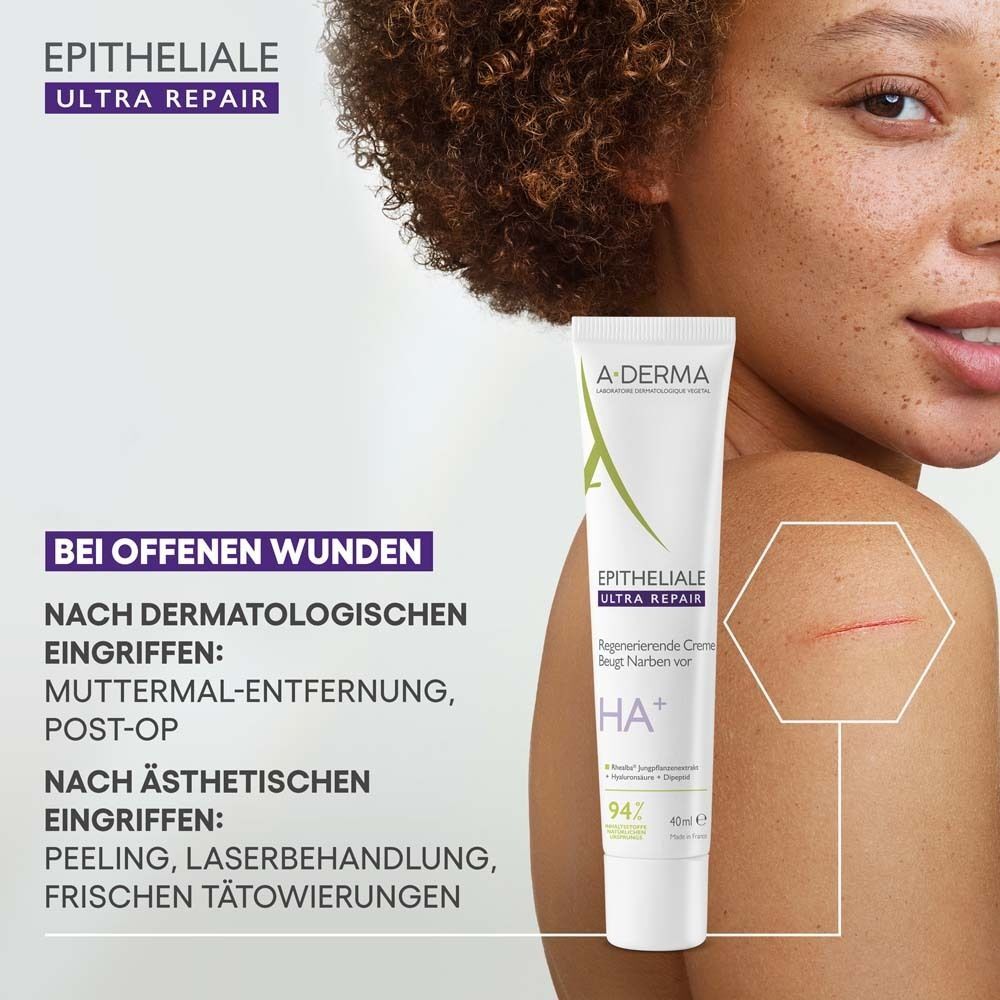 Frau mit Hautirritation. A-DERMA EPITHELIALE ULTRA REPAIR Creme-Tube. Text: EPITHELIALE ULTRA REPAIR. Text: Bei offenen Wunden.
