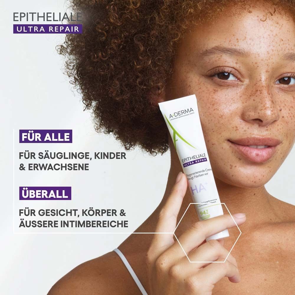 Frau hält A-DERMA EPITHELIALE ULTRA REPAIR Creme-Tube. Text: EPITHELIALE ULTRA REPAIR. Text: Für alle, für Säuglinge, Kinder & Erwachsene.
