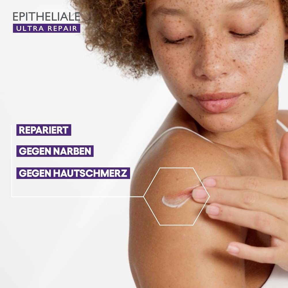 Frau mit Creme auf der Haut. Text: EPITHELIALE ULTRA REPAIR. Text: Repariert, gegen Narben, gegen Hautschmerz.