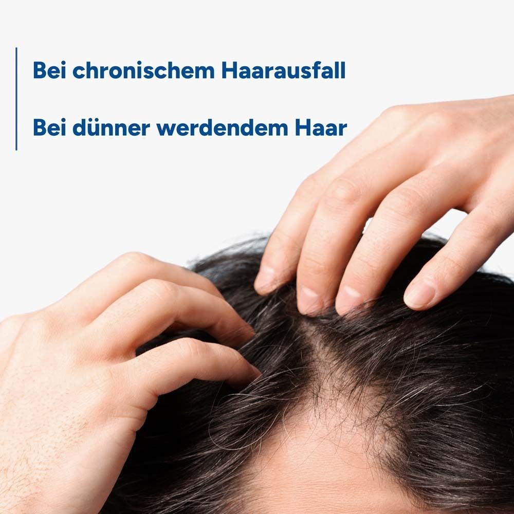 Hände auf Kopfhaut. Text: Bei chronischem Haarausfall. Bei dünner werdendem Haar.