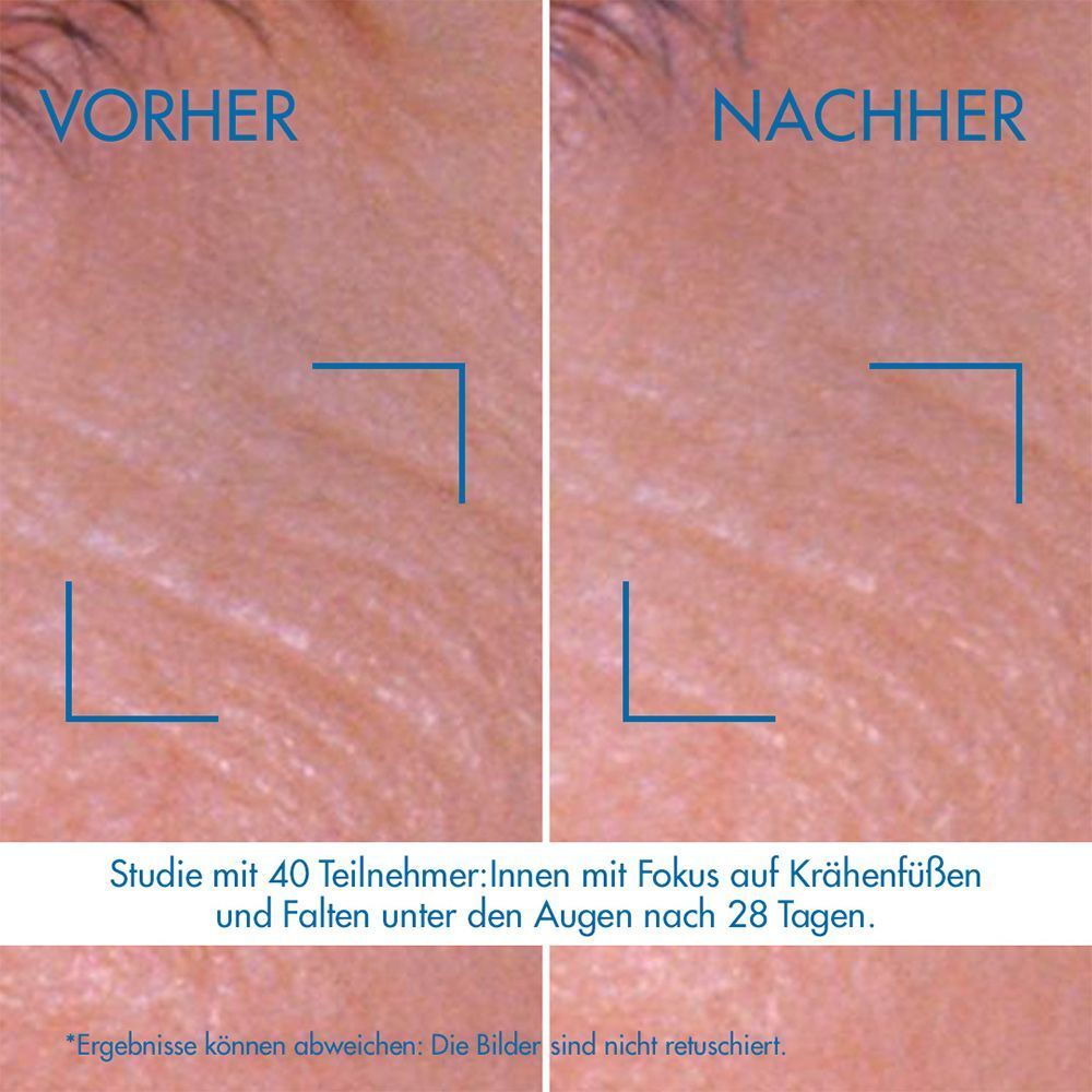 Vorher-Nachher-Vergleich von Hautpartien um die Augen. Text: Studie mit 40 Teilnehmern. Ergebnisse können abweichen.