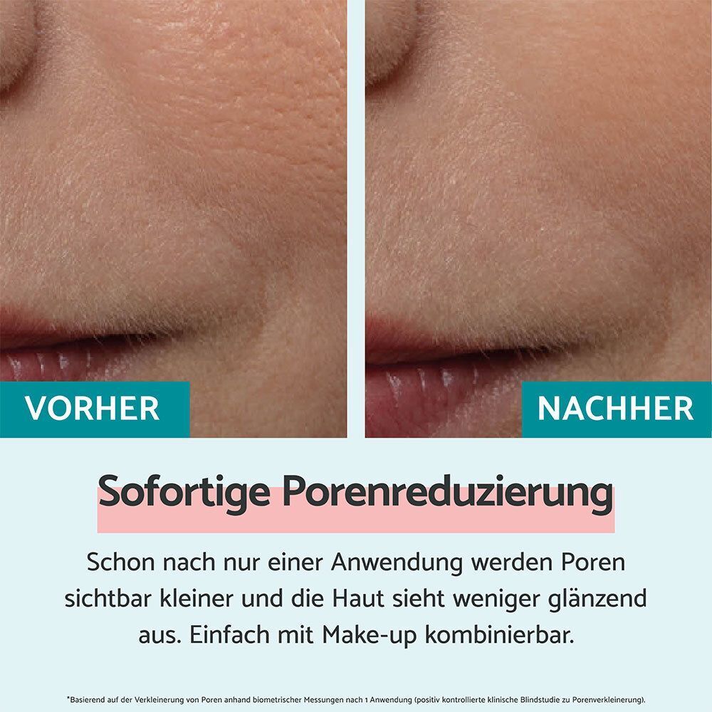 Vorher-Nachher-Vergleich. Haut mit Poren vor und nach der Anwendung. Text: Sofortige Porenreduzierung.