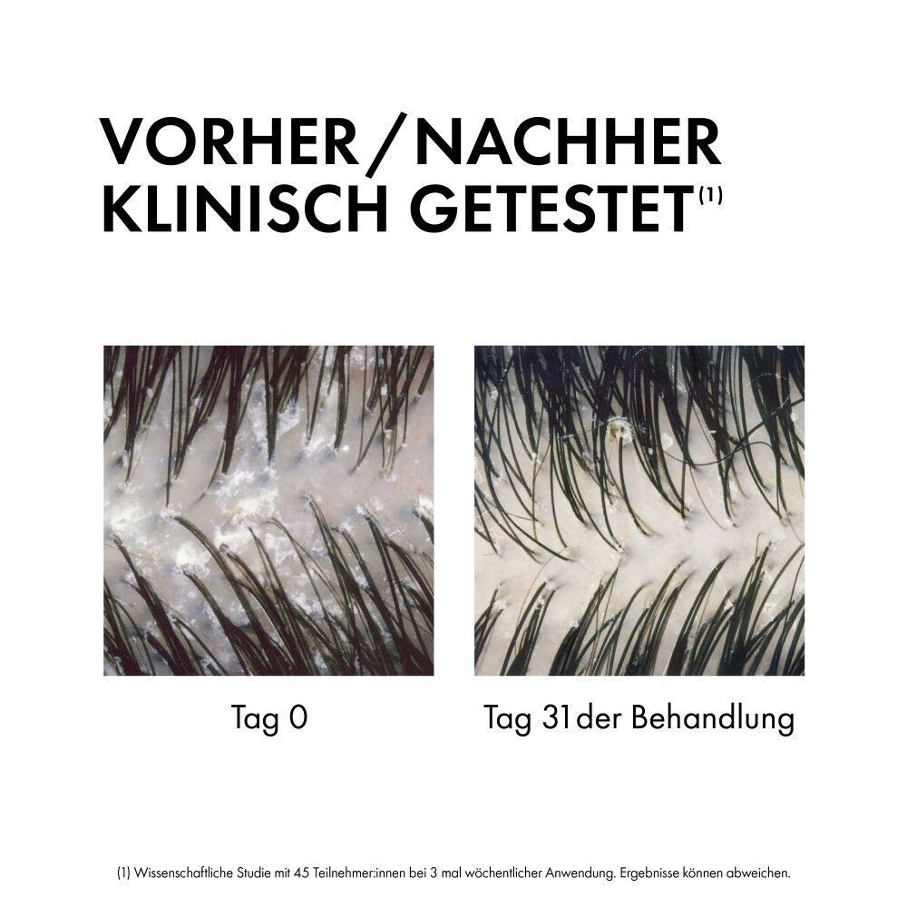 Vorher/Nachher-Bilder des Kopfes unter dem Mikroskop, die die Wirksamkeit der Behandlung zeigen.