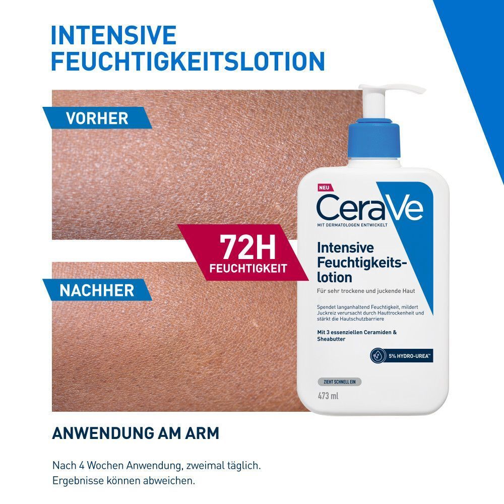Vorher/Nachher: CeraVe Intensive Feuchtigkeitslotion für 72H Feuchtigkeit.