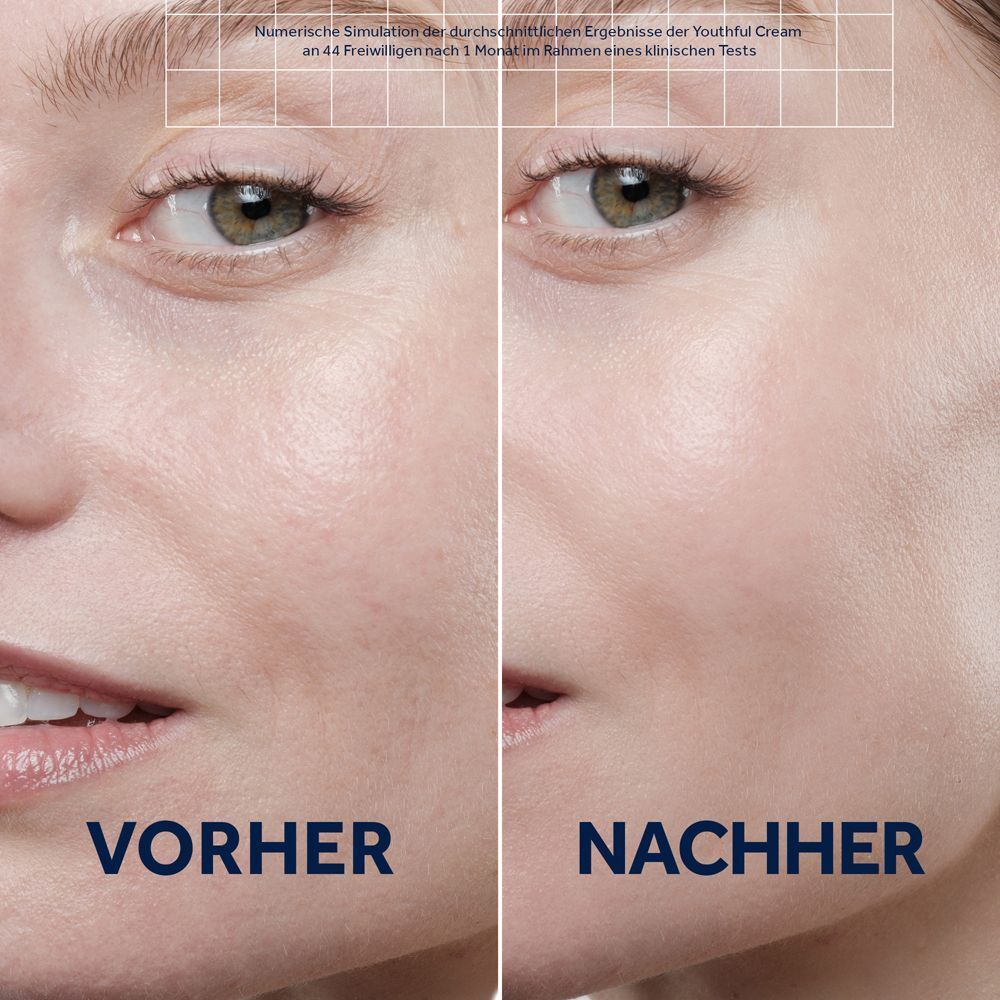 Vorher-Nachher-Vergleich der Haut einer Frau.