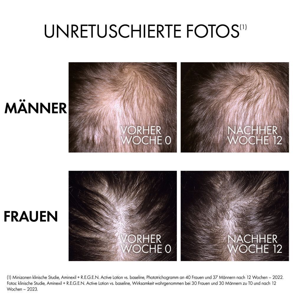 Vorher-Nachher-Vergleich von Männer- und Frauenhaaren nach 12 Wochen Anwendung.