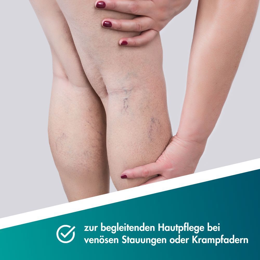 Beine mit sichtbaren Krampfadern, eine Hand hält das Knie.
