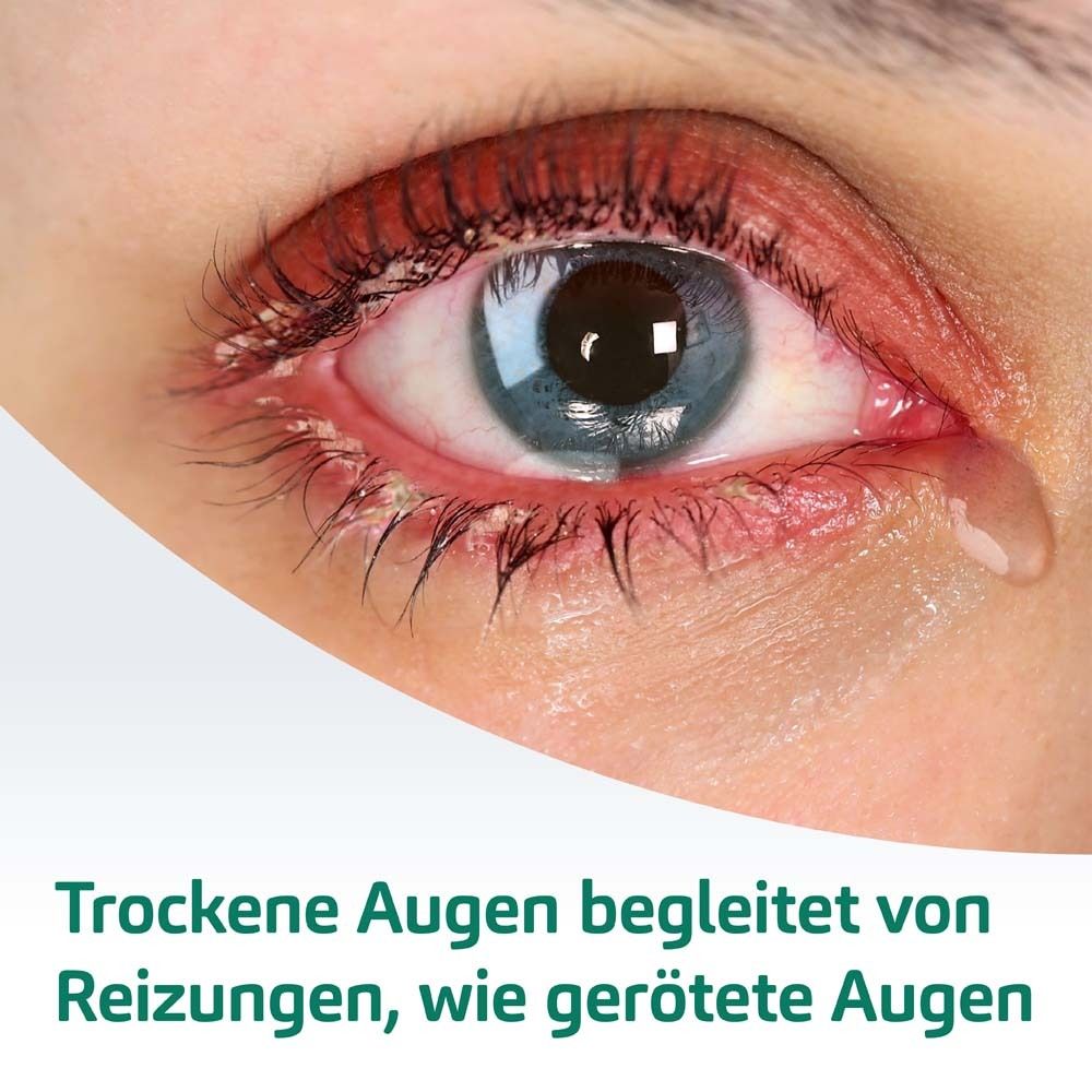 Nahaufnahme eines Auges mit Rötung und Tränen. Text: Trockene Augen begleitet von Reizungen, wie gerötete Augen.