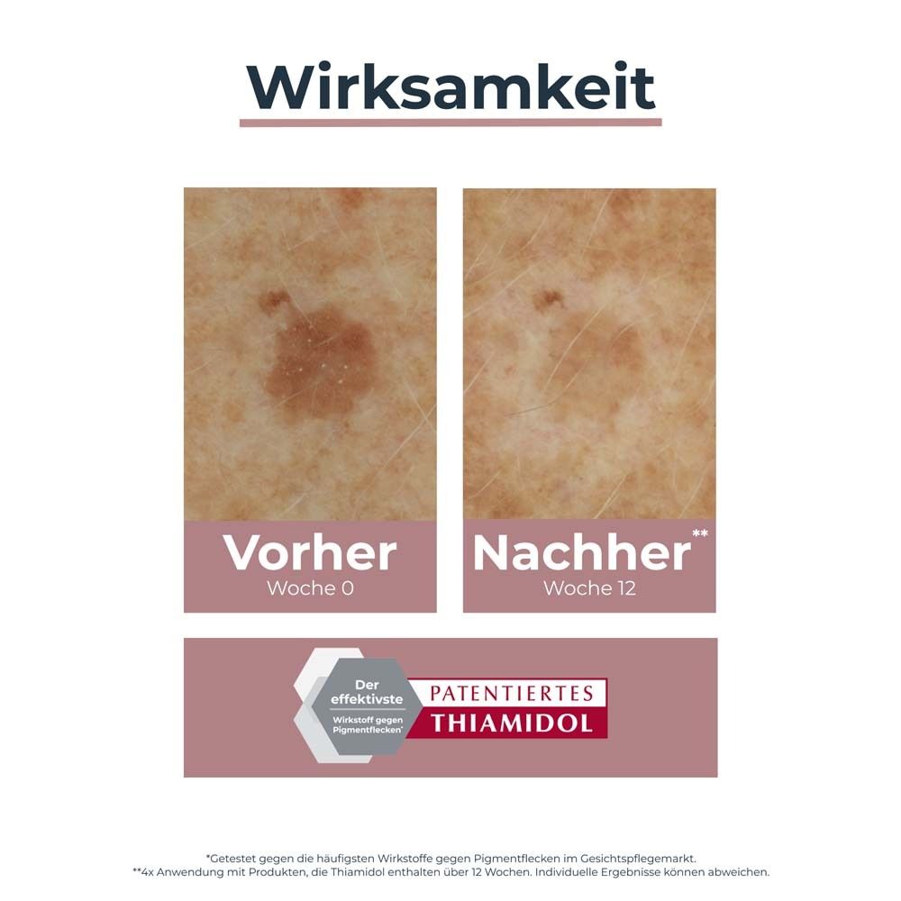 Eucerin Anti-Pigment Korrekturstift – Gegen Pigmentflecken