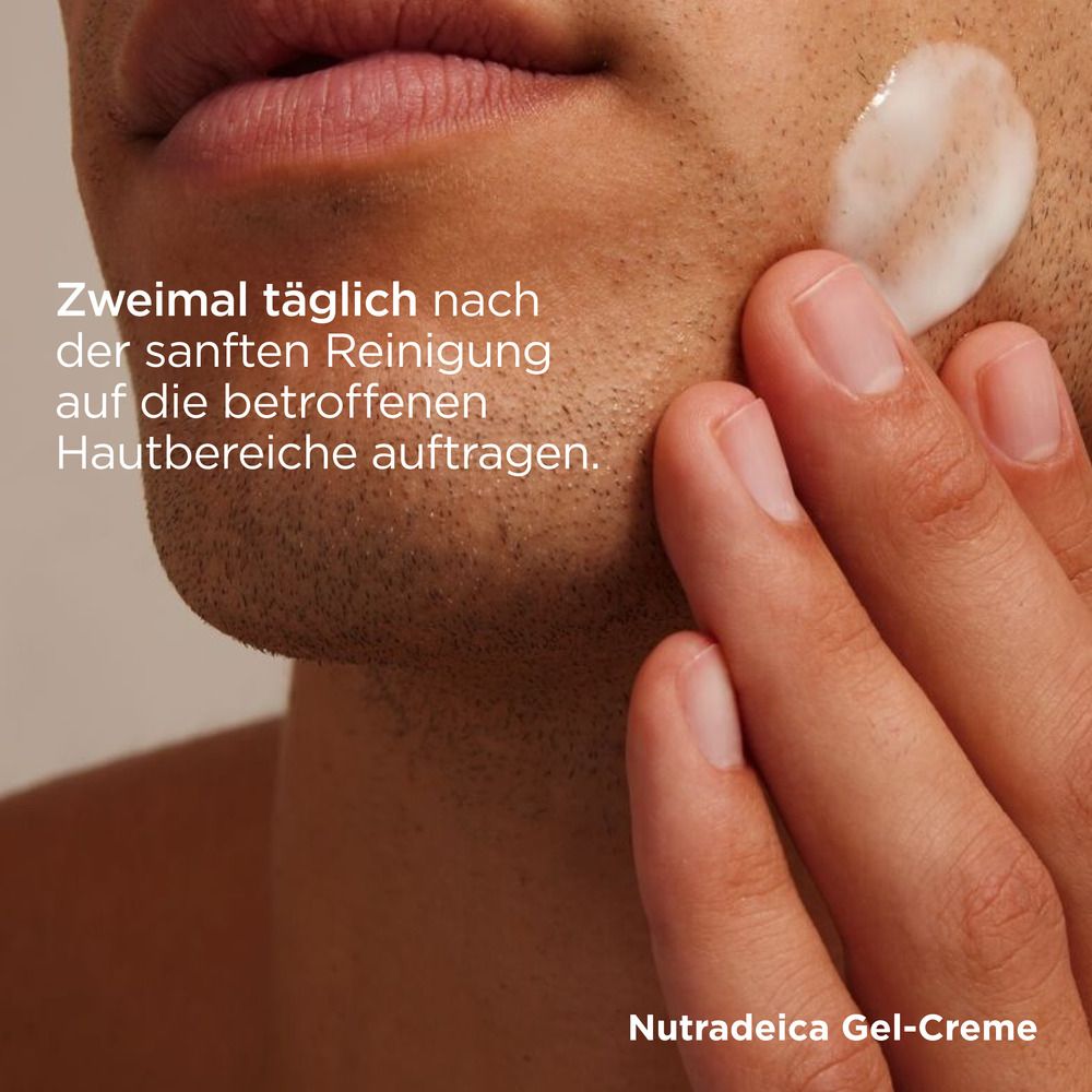 ISDIN Nutradeica® Gel-Creme beruhigende Gesichtscreme gegen Juckreiz, Schuppung und Rötung speziell bei seborrhoischer Dermatitis