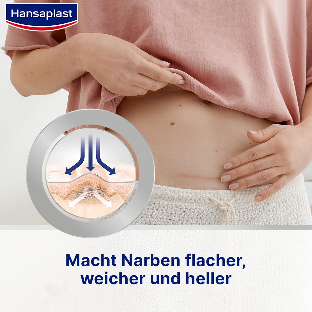 Hansaplast Narben Reduktion XL