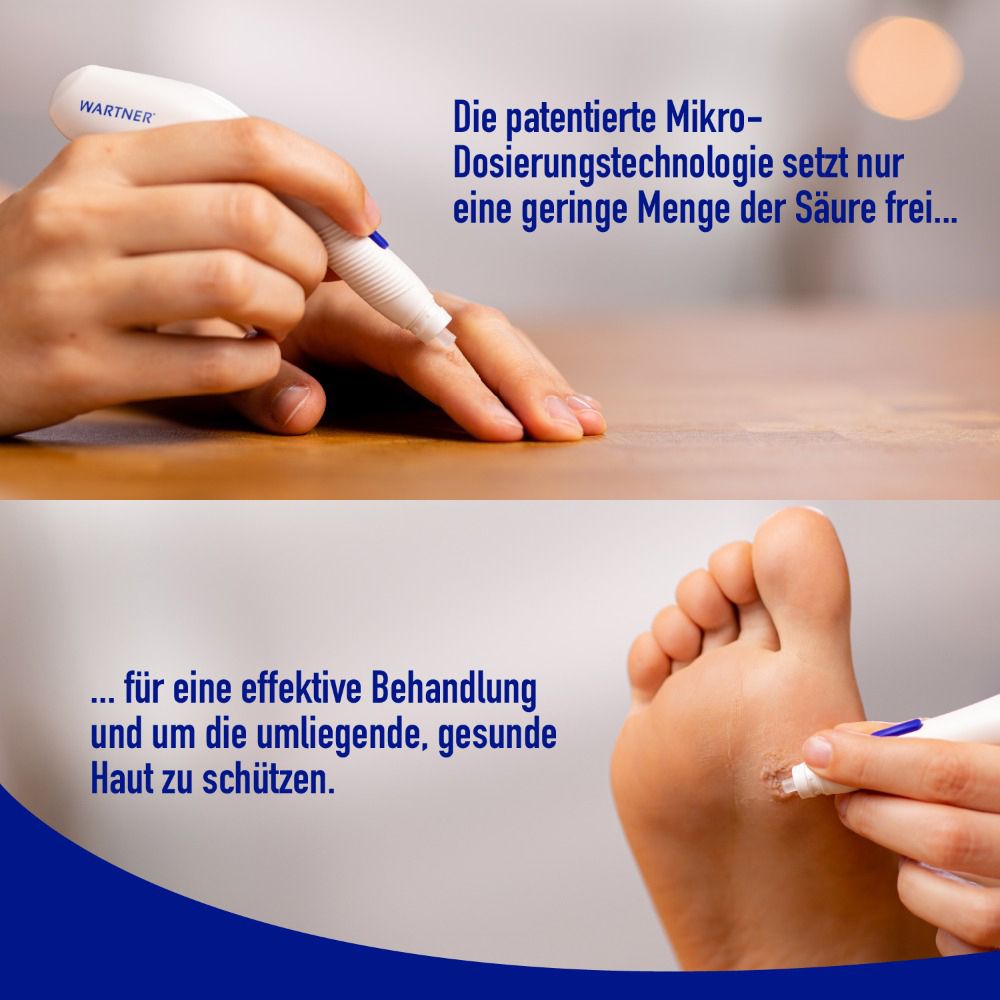 Hände und Füße mit Stift. Text: Die patentierte Mikro-Dosierungstechnologie setzt nur eine geringe Menge der Säure frei.
