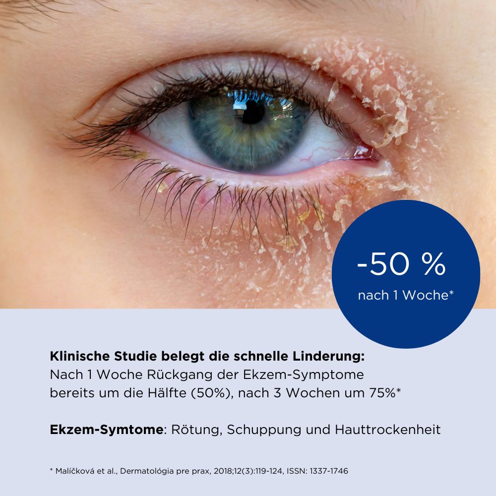 ALLERGIKA® Augenlidcreme MED