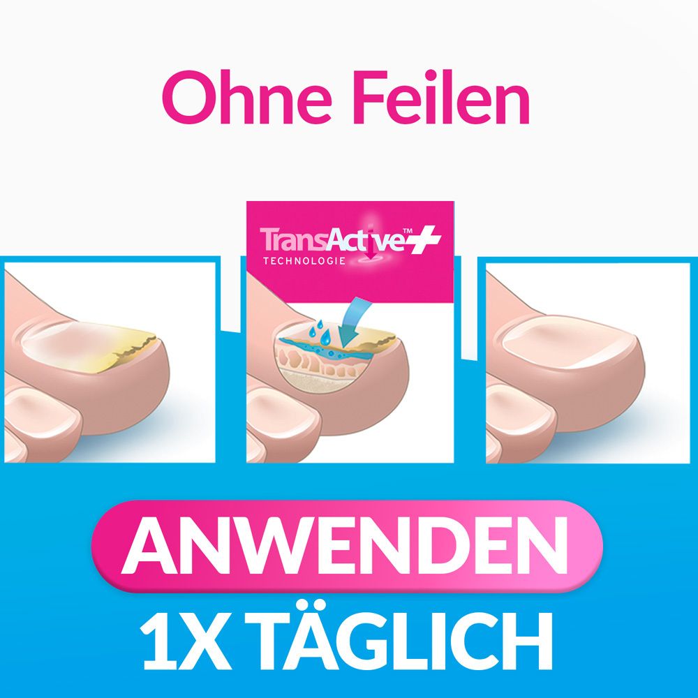Illustration der Anwendung von excilor® INTENSIV. 3 Schritte: Anwendung, TransActive+, 1x täglich. Text: Ohne Feilen.