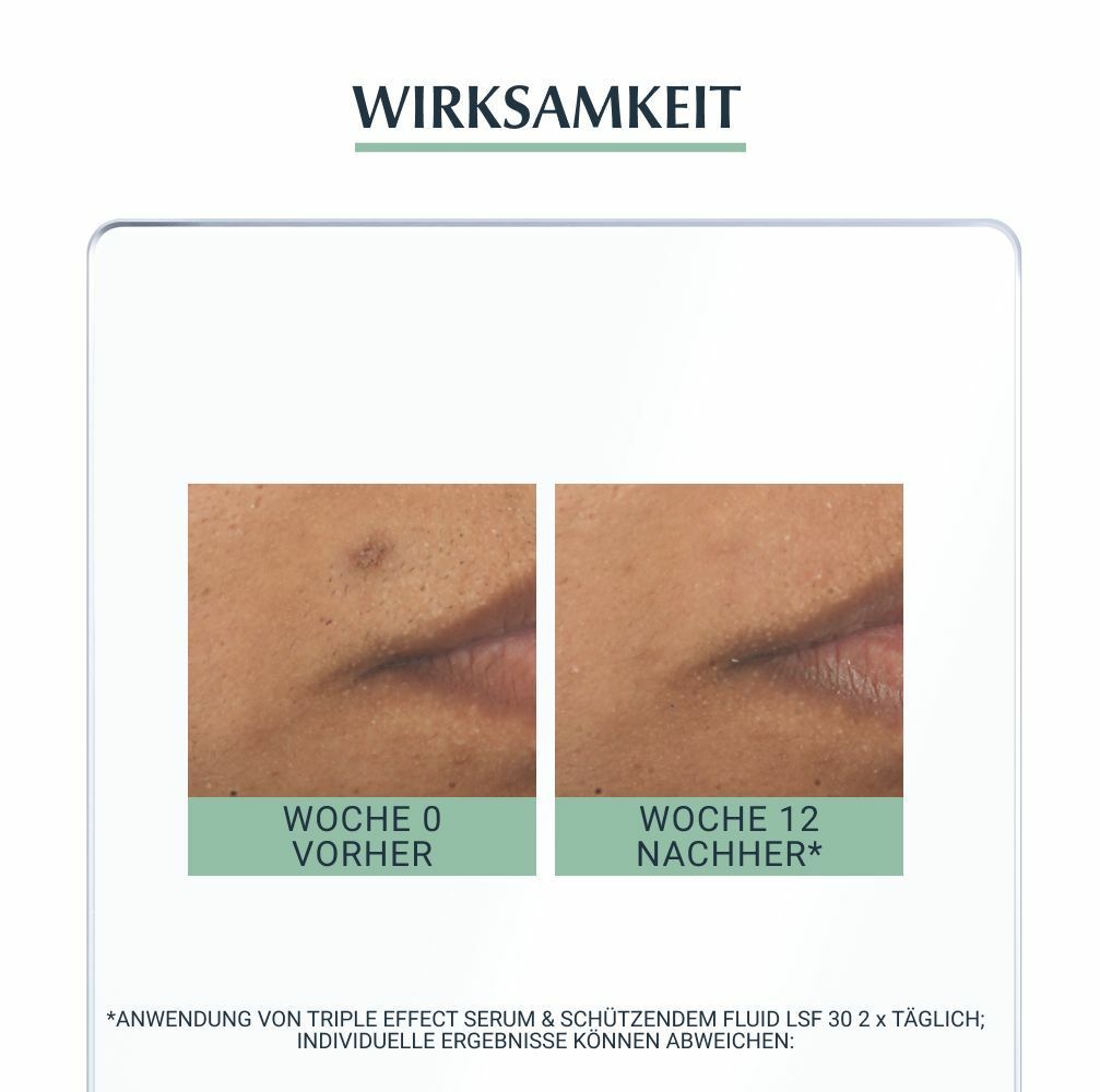 Eucerin® Dermopure Triple Effect Serum – Gesichtsserum gegen unreine Haut, Pickelmale und glänzende Haut, nicht komedogen