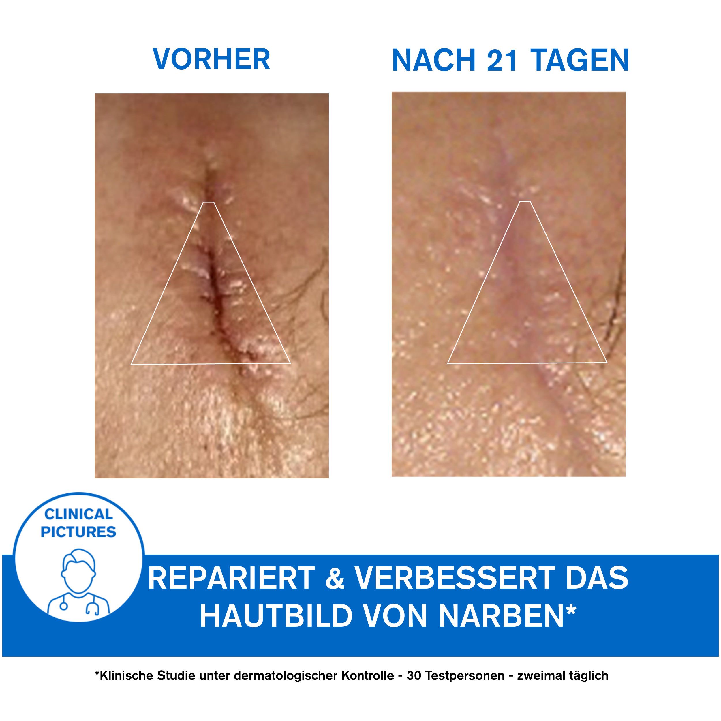 Weisse Creme auf Haut. Text: Geschädigte, geschwächte Haut. Extra reichhaltige Reparaturcreme. Gesicht & Körper.