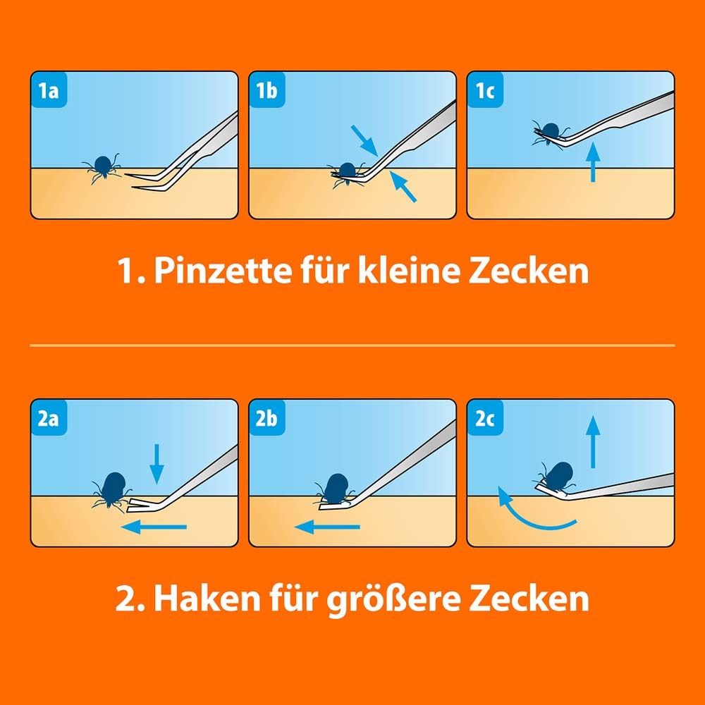 Illustrationen zur Anwendung von Pinzette und Haken zur Zeckenentfernung. Schritte 1a-1c und 2a-2c.