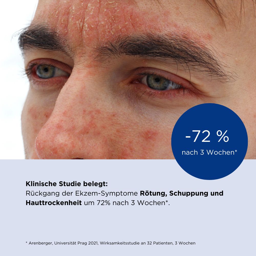 ALLERGIKA® Gesichtscreme MED