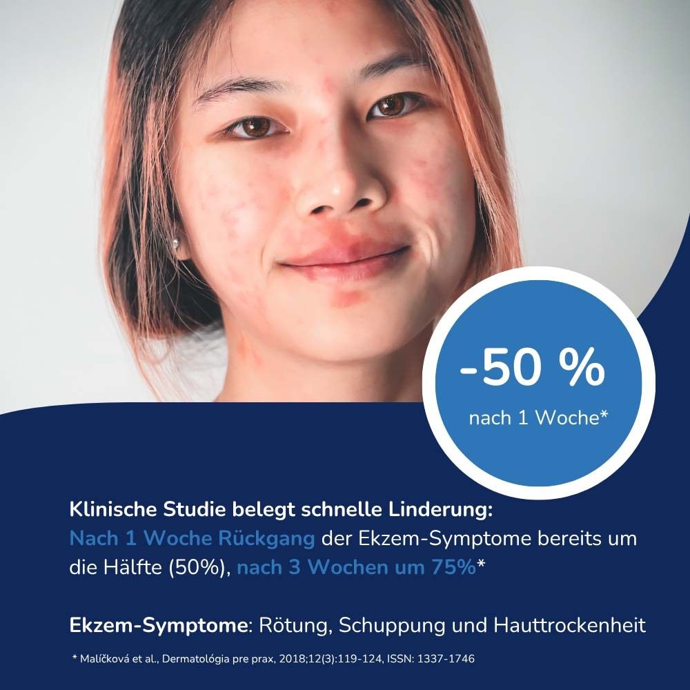 Frau mit Ekzemen im Gesicht. Text: -50% nach 1 Woche. Klinische Studie belegt schnelle Linderung. Ekzem-Symptome: Rötung, Schuppung, Hauttrockenheit.
