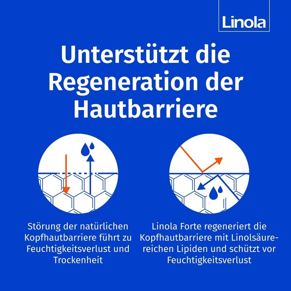 Linola Forte Kopfhaut-Tonikum - Haartonikum für juckende, trockene oder schuppige Kopfhaut