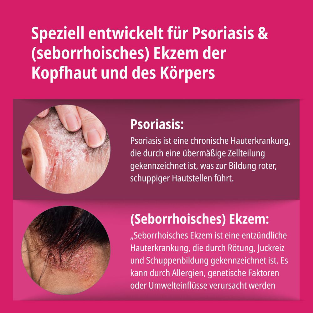 Evolsin Shampoo-Flasche. Frei von: Kortison, Parfum, Parabene, Antibiotika, Tierversuche. Dermatologisch getestet.