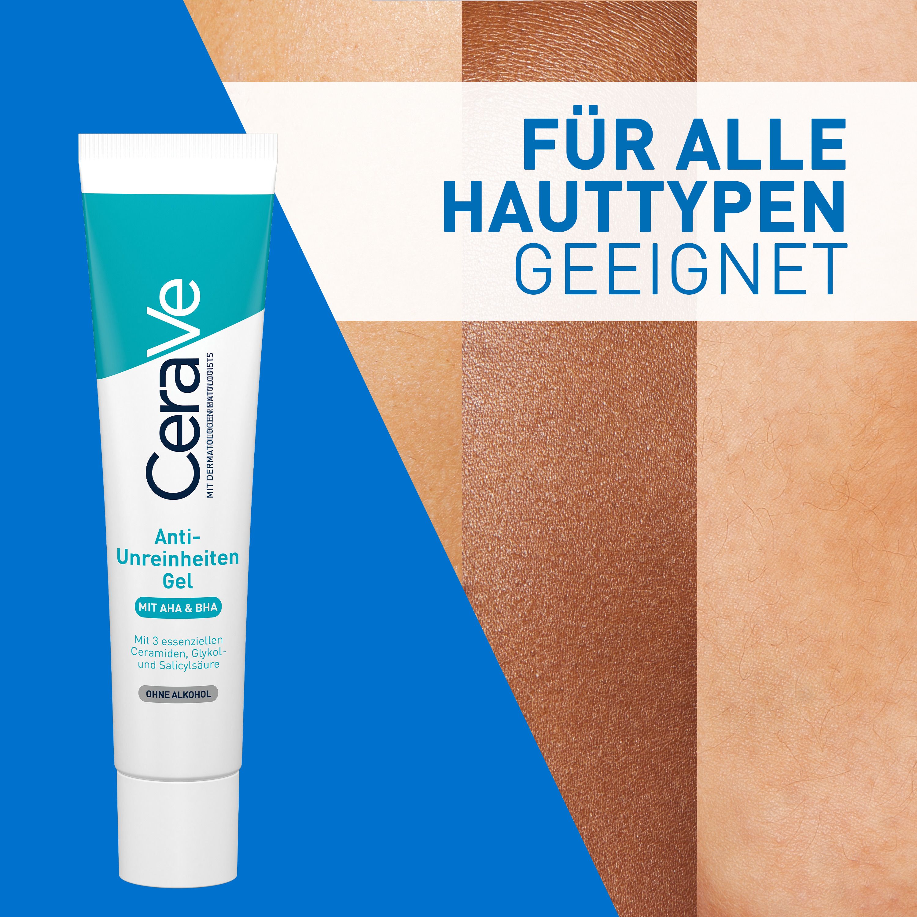 CeraVe Anti-Unreinheiten Gel: Klärende Pflege für unreine, zu Akne neigende Haut. Mit Peelingeffekt durch Glykolsäure und Salicylsäure