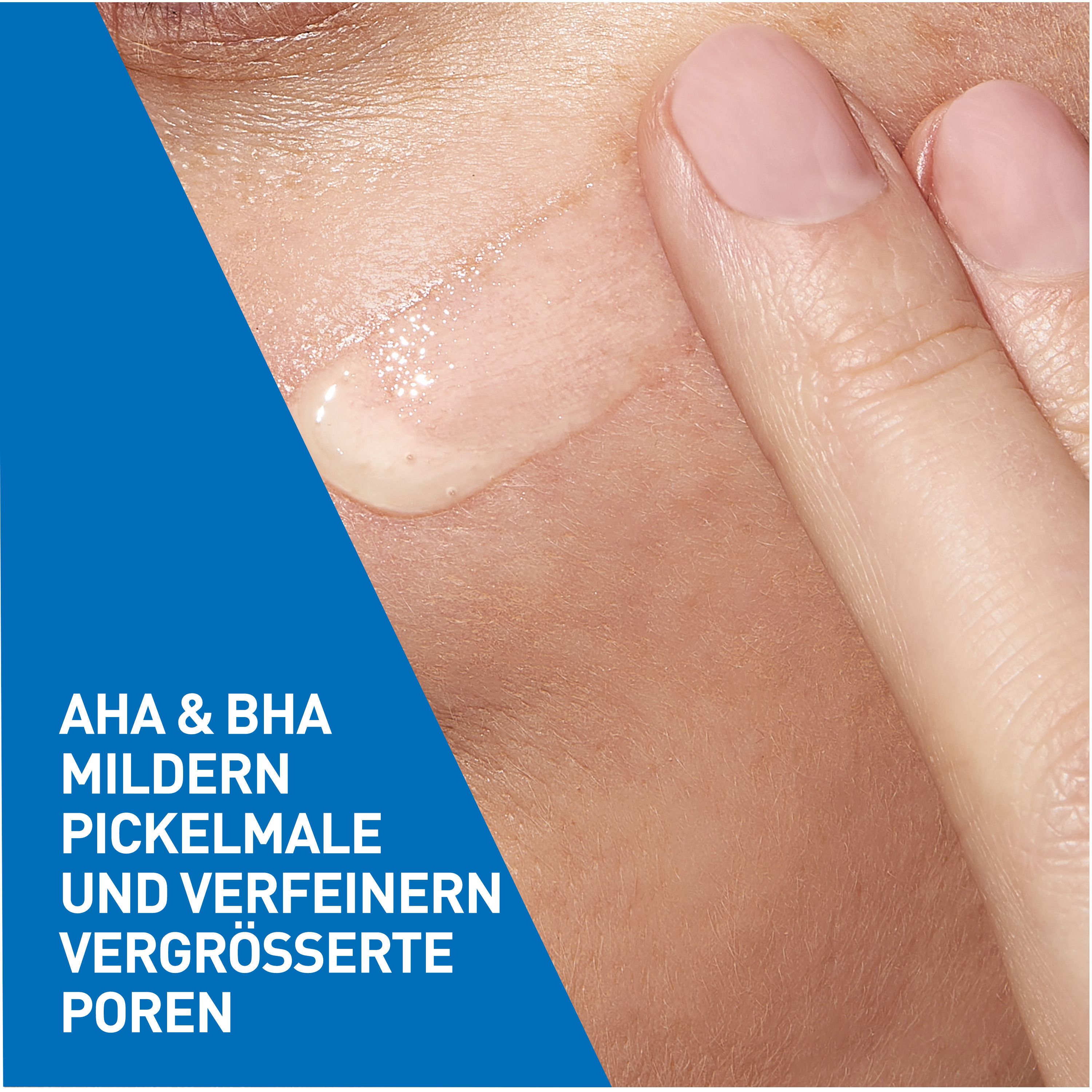 CeraVe Hautbilderneuerndes Retinol Serum bei unebener Haut