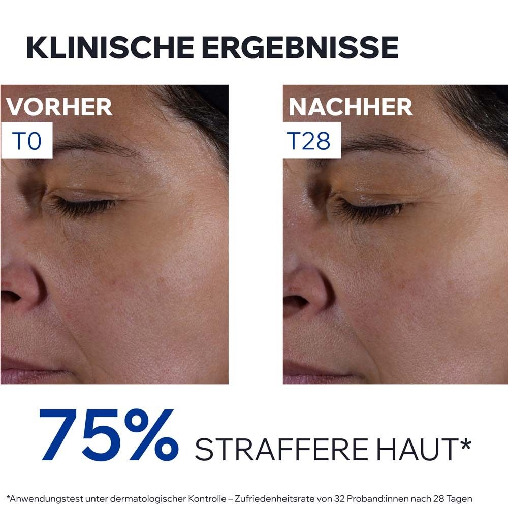 Vorher-Nachher-Vergleich. Gesichtshälften. T0 und T28. 75% straffere Haut. Anwendungstest unter dermatologischer Kontrolle.