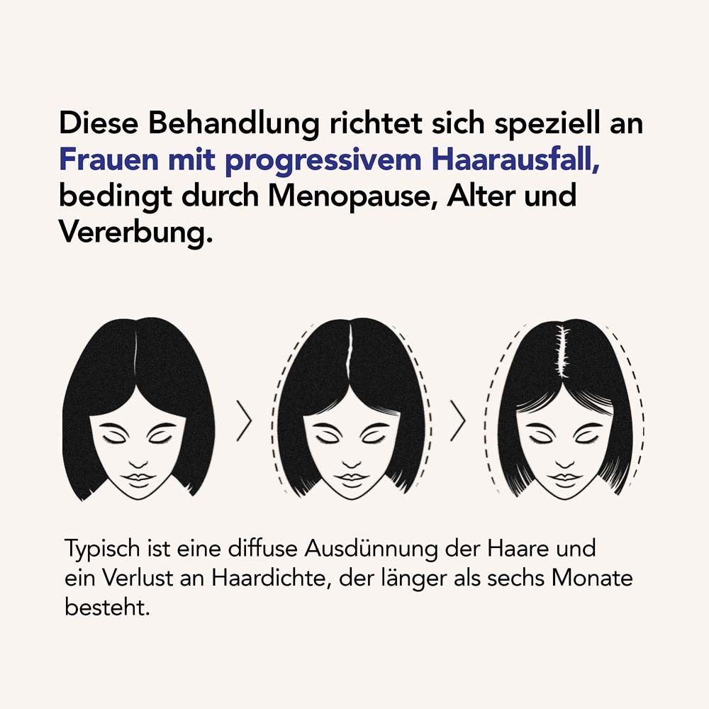 Grafik zeigt Haarausfall. Text: Diese Behandlung richtet sich speziell an Frauen mit progressivem Haarausfall.