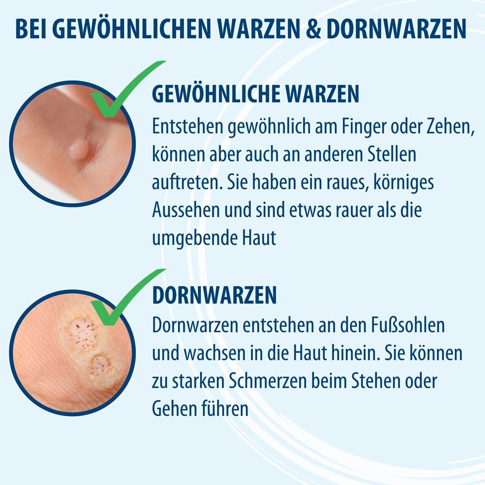 Seitenansicht der Evolsin Anti Warzen Stift Verpackung mit Anwendungshinweisen und CE-Kennzeichnung.