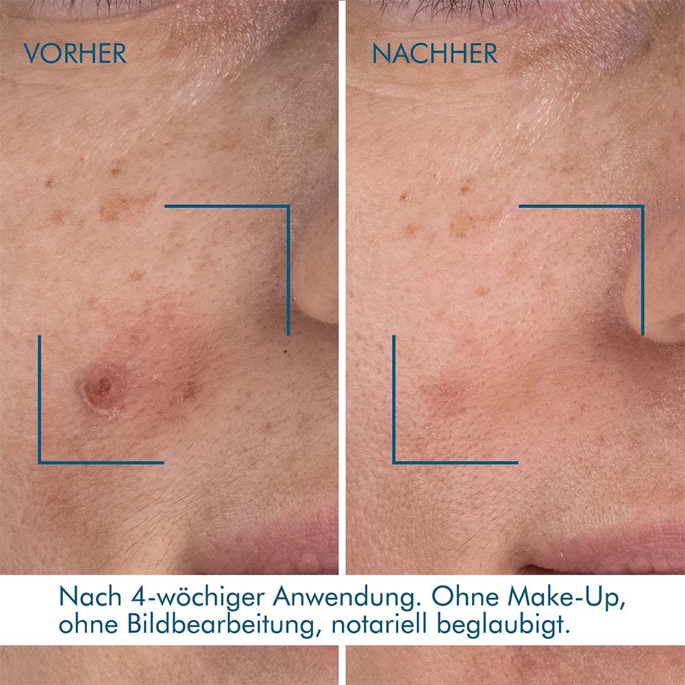 BIOTHERM Blue Retinol Nachtserum