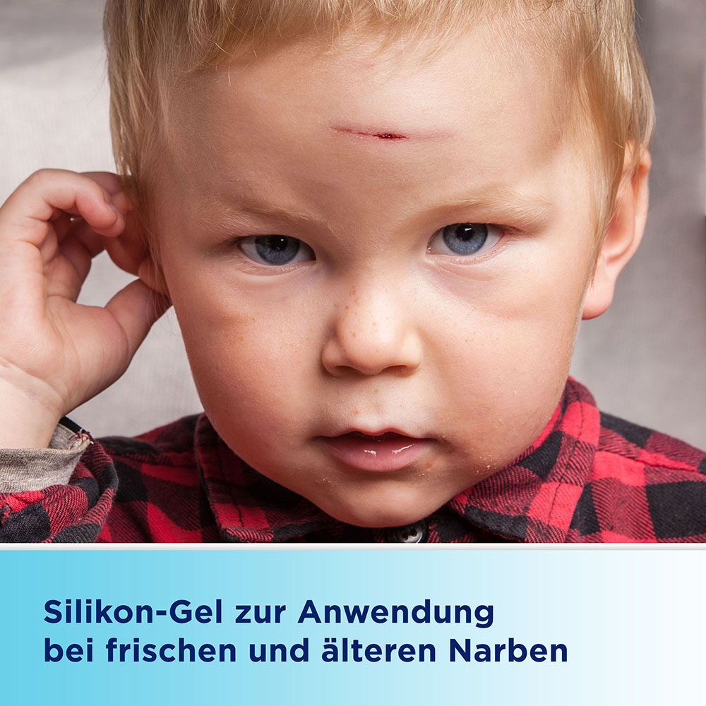 Kleines Kind mit Kratzer auf der Stirn. Text: Silikon-Gel zur Anwendung bei frischen und älteren Narben.