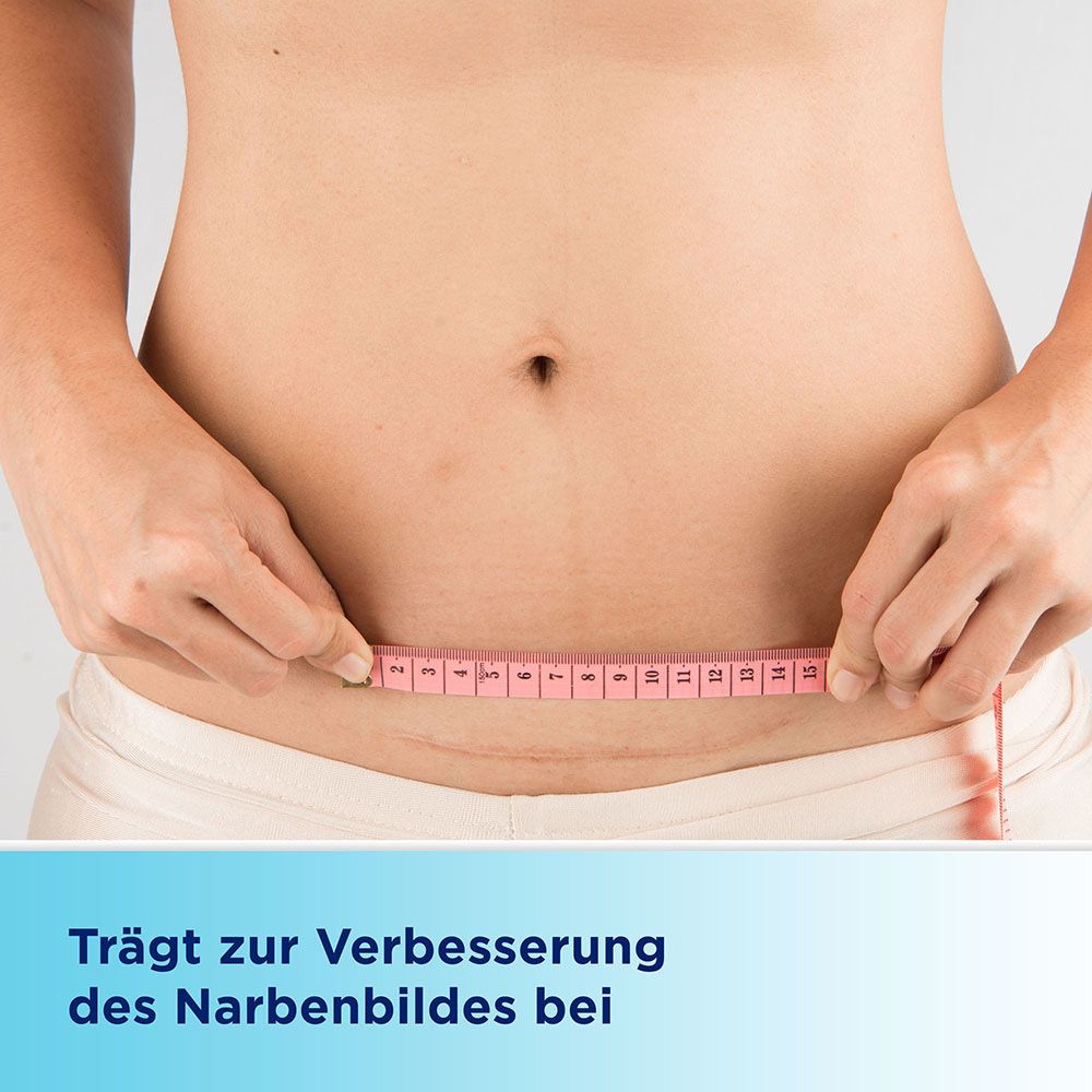 Bauch einer Person mit Narben. Maßband wird gehalten. Text: Trägt zur Verbesserung des Narbenbildes bei.
