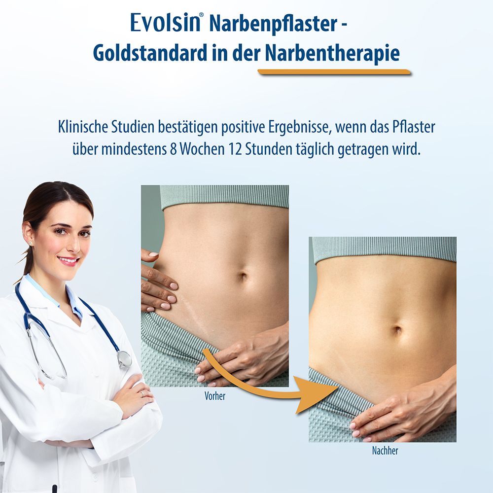 Evolsin® Transparentes Narbenpflaster – für Narben aller Art – Narbenpflaster aus Silikon reduziert sichtbar Narben - für eine einfache Behandlung (200 cm)