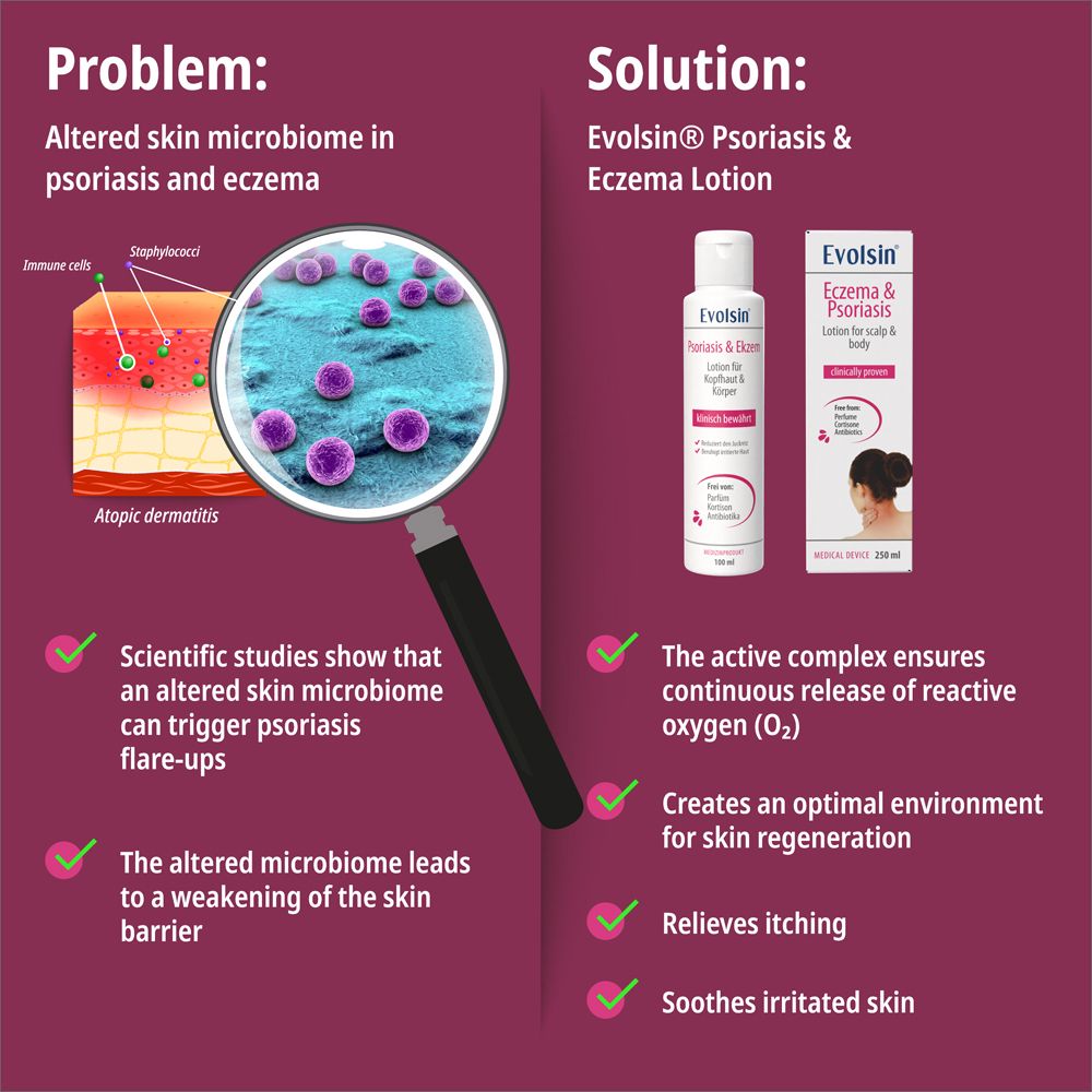 Weiße Flasche mit Lotion. Text: Evolsin Psoriasis & Ekzem Lotion für Kopfhaut & Körper. 100 ml. Medizinprodukt.