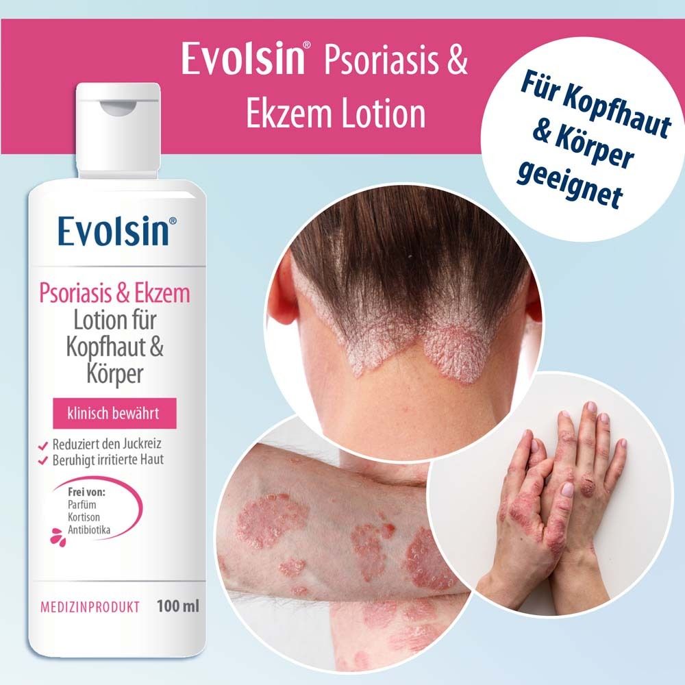 Weiße Flasche mit Lotion. Text: Evolsin Psoriasis & Ekzem Lotion. Geeignet für Kopfhaut & Körper. 100 ml. Medizinprodukt.