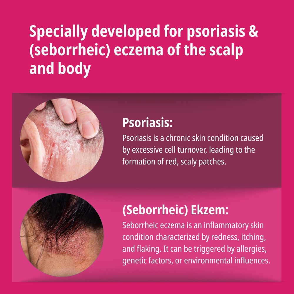 Weiße Flasche mit Lotion. Text: Evolsin Psoriasis & Ekzem Lotion für Kopfhaut & Körper. 100 ml. Medizinprodukt.