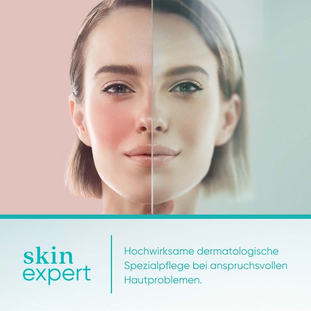 Gesicht einer Frau, Hälfte gerötet, Hälfte normal. Text: skin expert, dermatologische Spezialpflege.