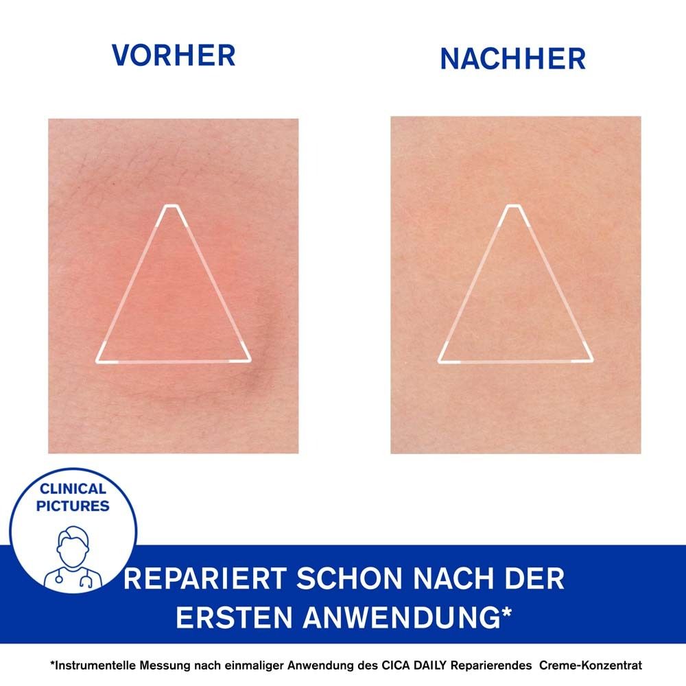 Zwei Hautbilder: Vorher und Nachher. Text: Repariert schon nach der ersten Anwendung.