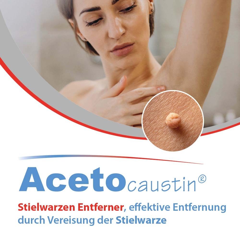 Nahaufnahme einer Frau mit einem Warzenentferner. Der Name Acetocaustin ist sichtbar.