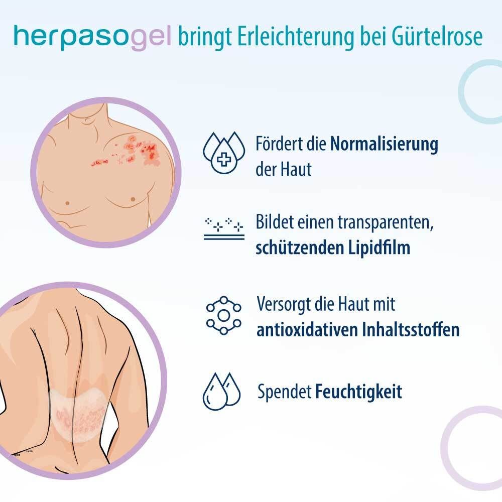 Herpasogel bei Gürtelrose | Fördert die Normalisierung der Haut bei Herpes zoster