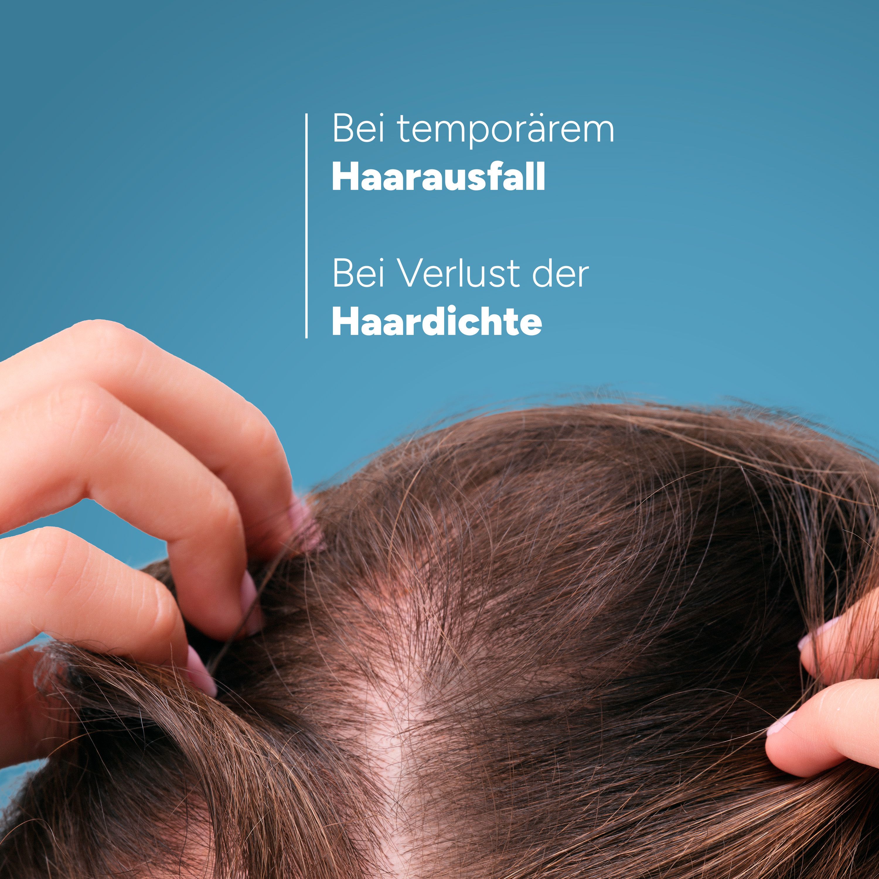 Hände auf Kopfhaut mit Haarausfall. Text: Bei temporärem Haarausfall, Bei Verlust der Haardichte.