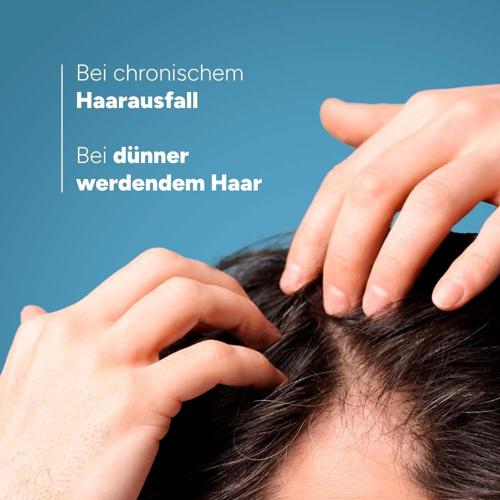 Hände auf Kopfhaut. Text: Bei chronischem Haarausfall, Bei dünner werdendem Haar.