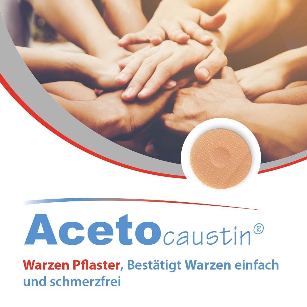 Hände zusammen. Acetocaustin Warzen Pflaster. Bestätigt Warzen einfach und schmerzfrei.