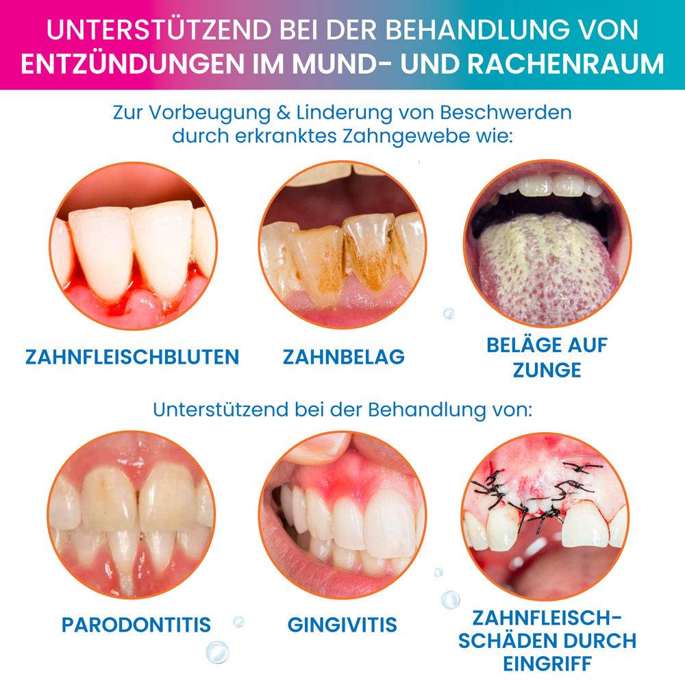 Abbildungen von Zahnproblemen: Zahnfleischbluten, Zahnbelag, Beläge auf Zunge, Parodontitis, Gingivitis, Zahnschäden.